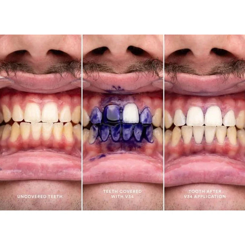 Hismile v34 Teeth Whitening Serum